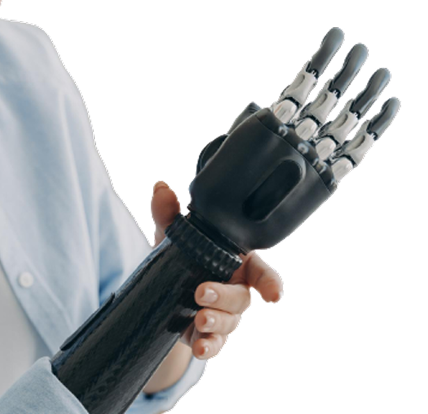 Prosthetic Hand